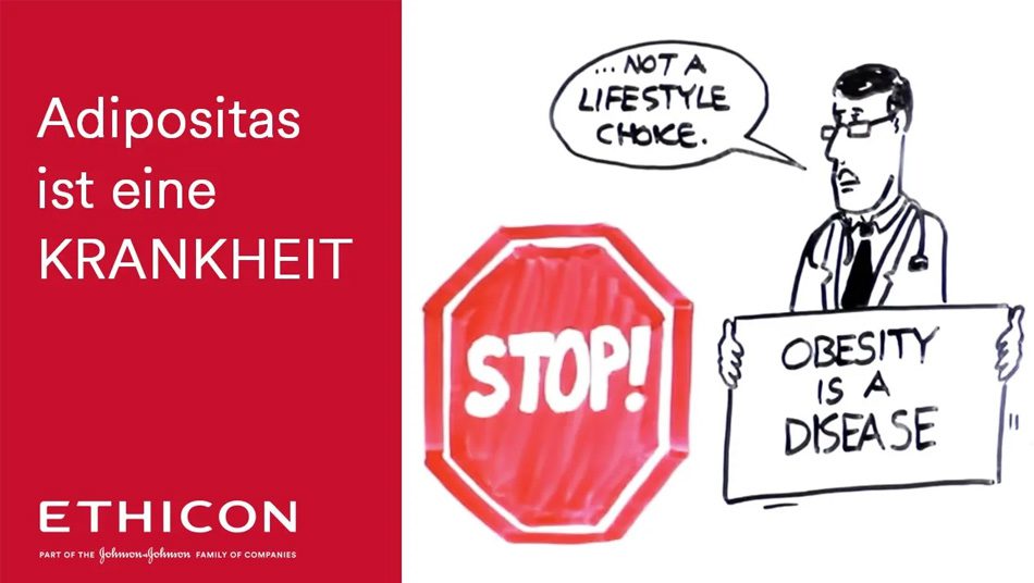 Video: Adipositas ist eine Krankheit